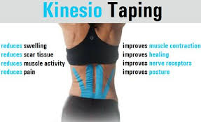 Kinematic taping technika